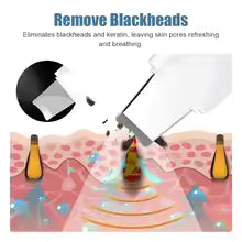 Deep Vibrate Skin Scrubber & Facial Peeling Cleaner